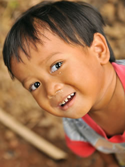 Global Incidence if Molar Hypomineralization Global Incidence if Molar Hypomineralization