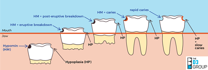 HPvsHMfig-copyright-TheD3Group HPvsHMfig-copyright-TheD3Group